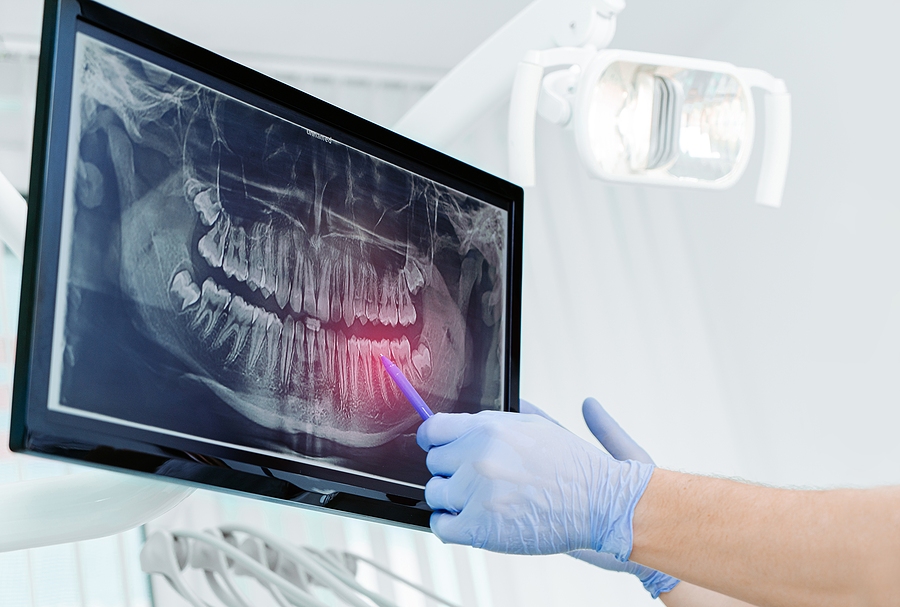 Hands Doctor Dentist In Gloves Show The Teeth On X-ray On Digita