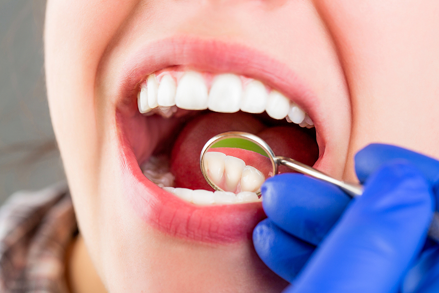 Dental Care, Taking Care Of Teeth. Girl Having Teeth Examined At