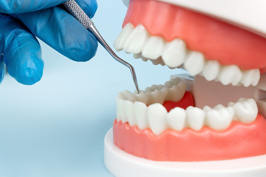Dentures Dental Teeth Model With Dentist Tool. Complete Denture